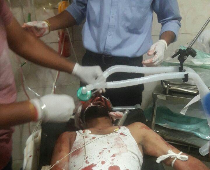 accident-three-boys-serious-injured-hoshiarpur-punjab (2)