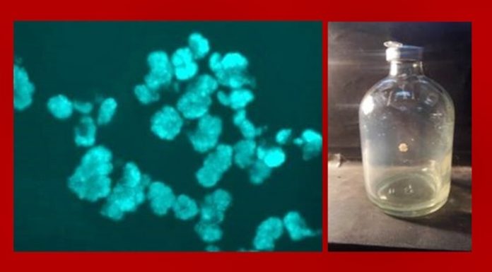 Methanosarcina sp. MSH10X1 bluish-green fluorescence under UV microscope