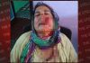 रास्ते को लेकर देवर ने भाभी पर किया तेजधार हथियार से जानलेवा हमला, हालत गंभीर