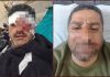 बहादुरपुर: जमीनी विवाद के कारण पारिवारिक झगड़े में तीन घायल, पुलिस ने शुरु की जांच