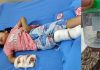 ट्यूशन जाते समय मासूम के पैर में लगी गोली, घायल