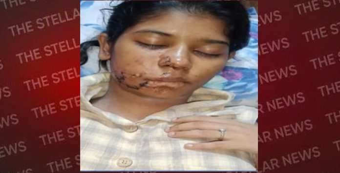 dog-attack-kanpur