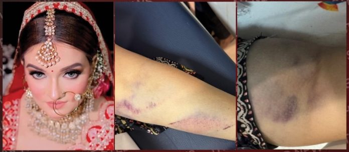 deepika murderacse